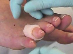 Rurki piankowe na odciążenia stóp RUCK® basic, zestaw 8 x 2 szt.