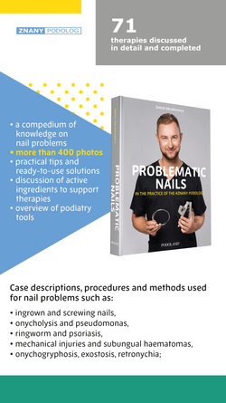 Książka - Paznokcie problematyczne w praktyce Znanego Podologa, wersja ENG