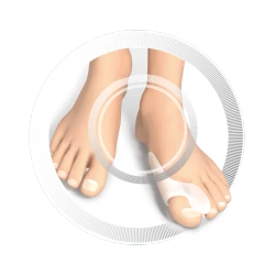 RUCK® nastawiacz smartgel dużego palca z ochroną na haluksa 4 szt.