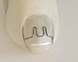 Orthonyxie Rading steps plier for bend Omega - Fraser