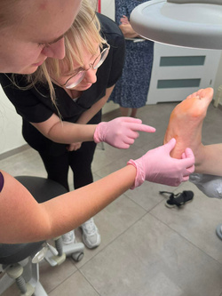 Terapia brodawek wirusowych