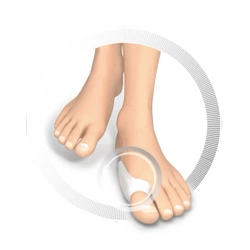 RUCK® Silikonowy ochraniacz na haluksa, 10 szt.