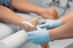 RUCK® occlusion 15 x 15 cm, 10 pieces