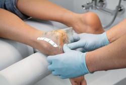 Maść na pękające pięty - peclavus® PODOcare Schrundensalbe, 250 ml