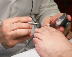 Naczynko silikonowe dappen dish RUCK®