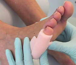 Rurki piankowe na odciążenia stóp RUCK® basic, zestaw 8 x 2 szt.