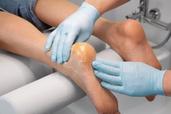 Maść na pękające pięty - peclavus® PODOcare Schrundensalbe, 250 ml