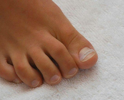 Ortho Glue® - klej do klamer ortonyksyjnych, 7 ml