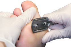 Omega poprzeczna RUCK®, ścinak do zrogowaciałej skóry stóp