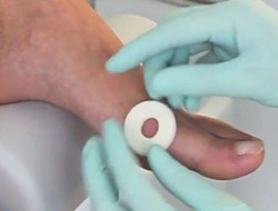 Orteza filcowa RUCK® basic, krążki białe, 5 mm, 40 szt.