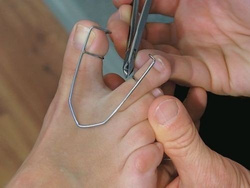 Metalowy rozwieracz międzypalcowy, mały - 1 szt.