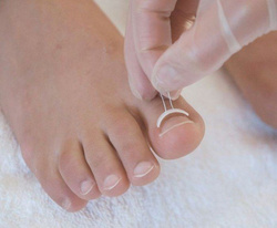 Klamra na wrastające paznokcie, Podofix, rozm. M, 8 szt.