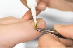 Kopytko metalowe RUCK® aplikator klamry na wrastające paznokcie