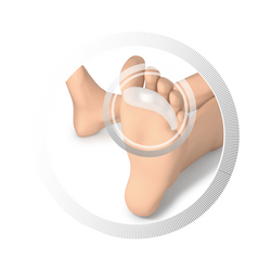 RUCK® smartgel hammer toe pad 20 mm - 4 pcs