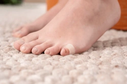 Obrączki żelowe na mały palec stopy RUCK® smartgel, 4 szt.