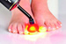 Fotodynamiczna terapia PACT® MED przeciw grzybicy paznokci