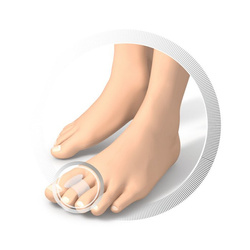 Specjalistyczny separator pierścieniowy do stóp RUCK® smartgel, średni, 4 szt.