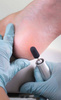 RUCK Certyfikowane kapturki ścierne do pedicure, Ø 7 mm / ziarn. 150 (10 szt.)