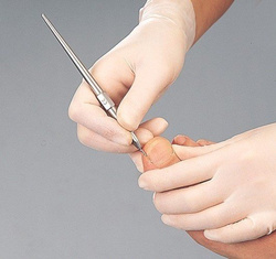 Dłutko podologiczne RUCK® rozm. 2 mm, 20 szt.