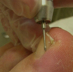 Busch - milling cutter of stainless steel