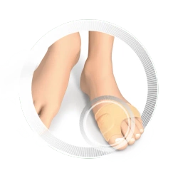 RUCK® smartgel osłona ochronna na haluksy, rozm. 36-40, 3 mm, 4 szt.