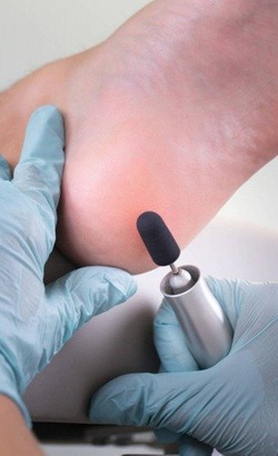 RUCK Certyfikowane kapturki ścierne do pedicure, Ø 5 mm / ziarn. 240 (50 szt.)