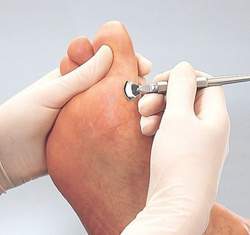 Uchwyt do dłuta podologicznego RUCK®