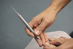 RUCK® double probe, design diabetic 1 mm