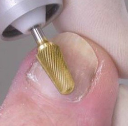 Busch – SPEED – surgical steel Titan-Nitrid