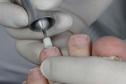 Busch - Corundum Milling Cutter, 524-055