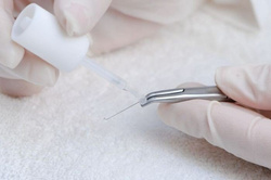 Ortho Glue® - klej do klamer ortonyksyjnych, 7 ml