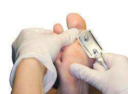 Omega poprzeczna RUCK®, ścinak do zrogowaciałej skóry stóp